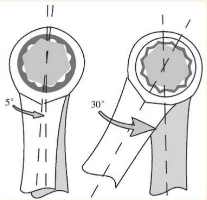 【梅花棘輪扳手為什么比棘輪套筒扳手好用】圖4