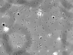 【汽車尾氣的危害有哪些？吸多了會患上老年癡呆】圖2