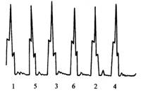 【柴油機的供油壓力及波形分析】圖3