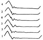 【柴油機的供油壓力及波形分析】圖4