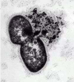 空調(diào)濾清一般多少錢？100元的空調(diào)濾和20元的有什么區(qū)別？